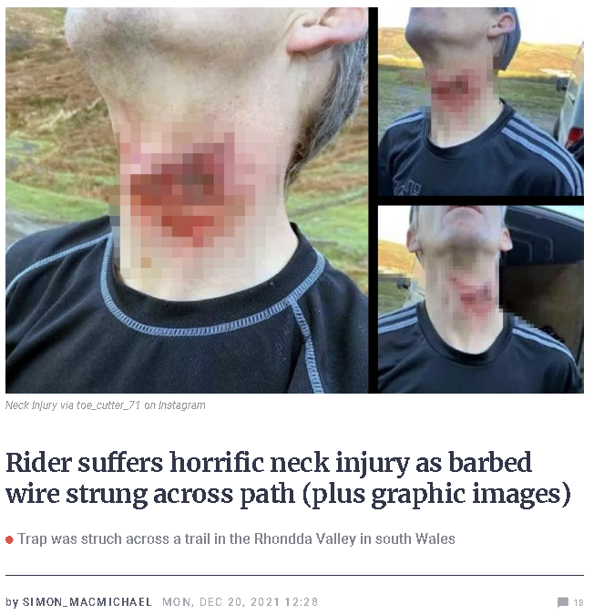 420_Bike_Life's tweet photo. @bikefreek Good luck. I hope you catch them.
#Nails #Tacks #Flats #Crash #BarbedWire #Cycling #ClimateAction #BanCars #MirrorsAreMeantToBeBroken
Good karma catching people trying to harm others. https://t.co/1LAGMpv8KC
