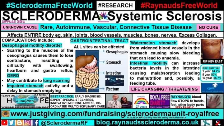 Gastrointestinal Tract Complications Infographic #SclerodermaAwarenessMonth 🌻
blog.raynaudsscleroderma.co.uk/2018/05/gastro… #SclerodermaFreeWorld #RaynaudsFreeWorld 
#Research #Scleroderma #SystemicSclerosis #Raynauds #Autoimmune #RareDisease #NoCure #UnknownCause #LifeChanging #ConnectiveTissue #SSc