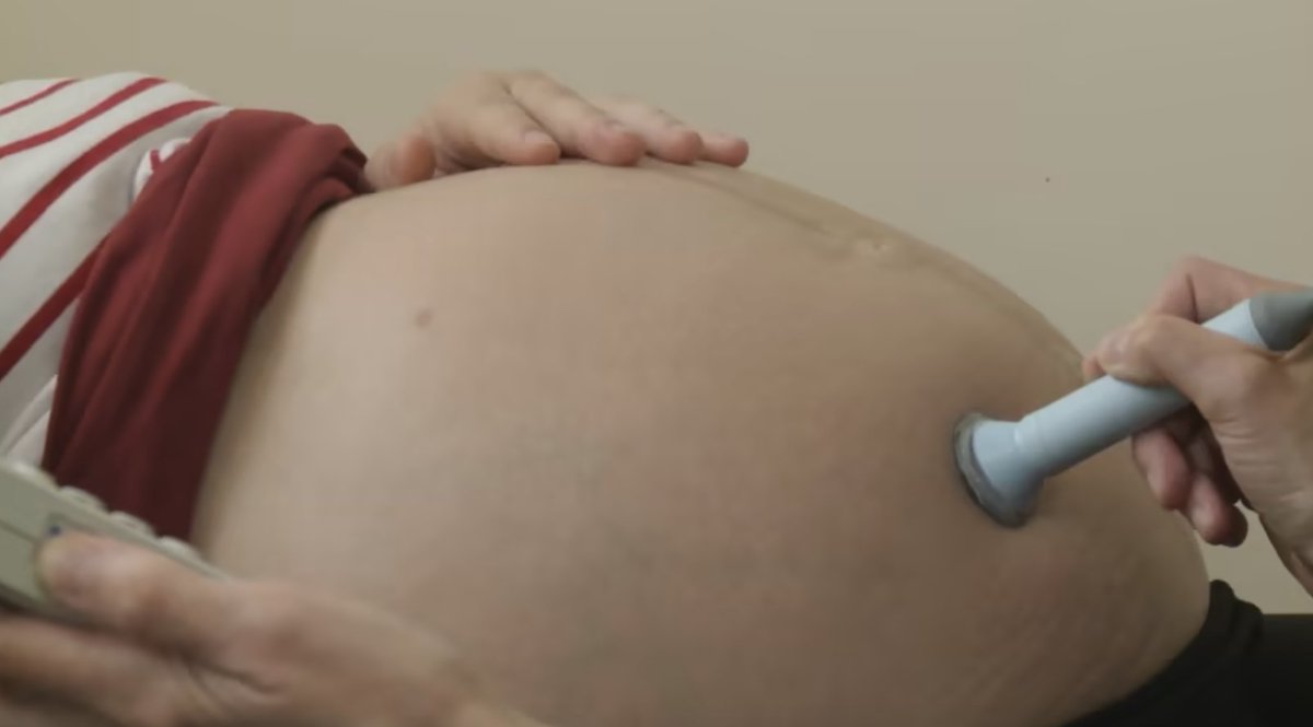 vicwhittamITV's tweet photo. The safety of maternity services has been highlighted as a serious concern among staff across Yorks &amp; N. Lincs. 90% of those questioned by the RCN said staffing levels were unsafe, - worst region in the country.  The Dept for Health say it's investing a record amount. https://t.co/kRzwaw8xcb