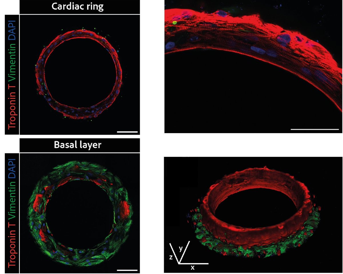 4Dcell (@4dcell) on Twitter photo You've seen our beating cardiomyocyte rings and you want to know more? Check out our publication in <a href="/eLife/">eLife - the journal</a> , fresh off the press! #organInaWell #cardiacRing <a href="/DrHulot_PARCC/">Jean-Sébastien Hulot</a> doi.org/10.7554/eLife.… You've seen our beating cardiomyocyte rings and you want to know more? Check out our publication in <a href="/eLife/">eLife - the journal</a> , fresh off the press! #organInaWell #cardiacRing <a href="/DrHulot_PARCC/">Jean-Sébastien Hulot</a> doi.org/10.7554/eLife.…