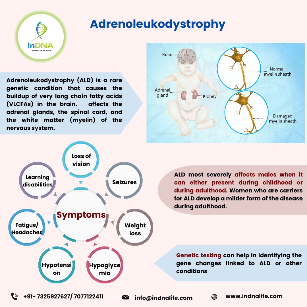 Adrenoleukodystrophy, ALD, is a genetic disorder connected to the X chromosome. Symptoms of ALD often include behavioral and cognitive changes. ALD affects males more than females. Genetic testing can help in detection of the mutation responsible for causing the disorder.
#ALD