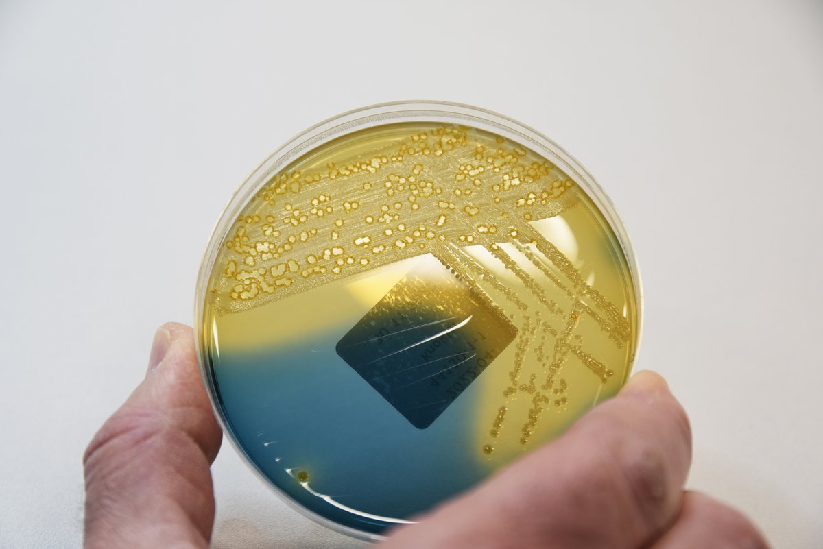 Seks personer rammet av E.coli-utbrudd. Veterinærinstituttet er med i den pågående utbruddsetterforskningen initiert av Folkehelseinstituttet, sammen med aktuelle kommuneoverleger og Mattilsynet.bitly.ws/IDFY