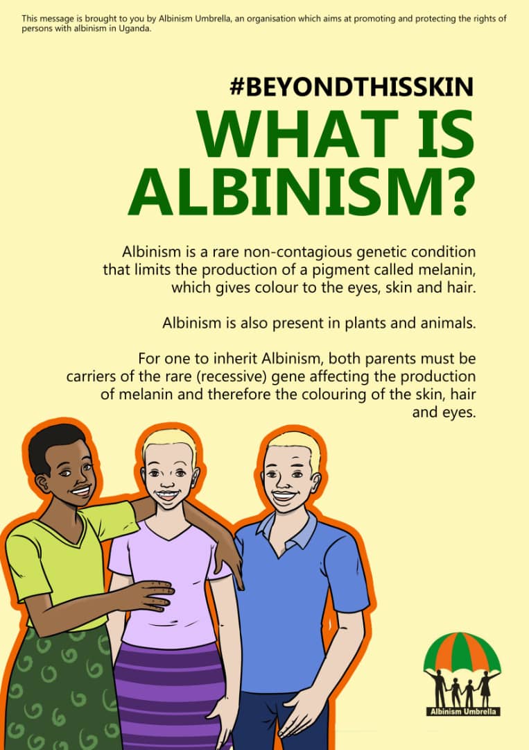 albinismumbrell's tweet image. As you walk around the streets of Kampala, you'll notice our flyers set up on different parts.

They contain facts and information about albinism, and remedies to myths and superstitions that surround the condition.
#HaveARead 
#AccessForAlbinism 
#ActionForAlbinism