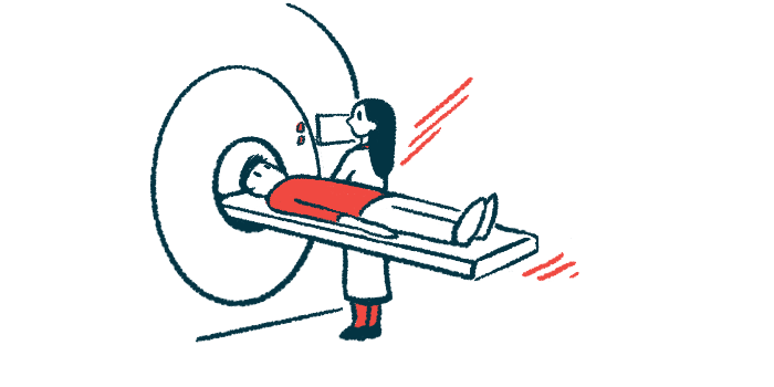 Multiple Sclerosis News Today tweet media