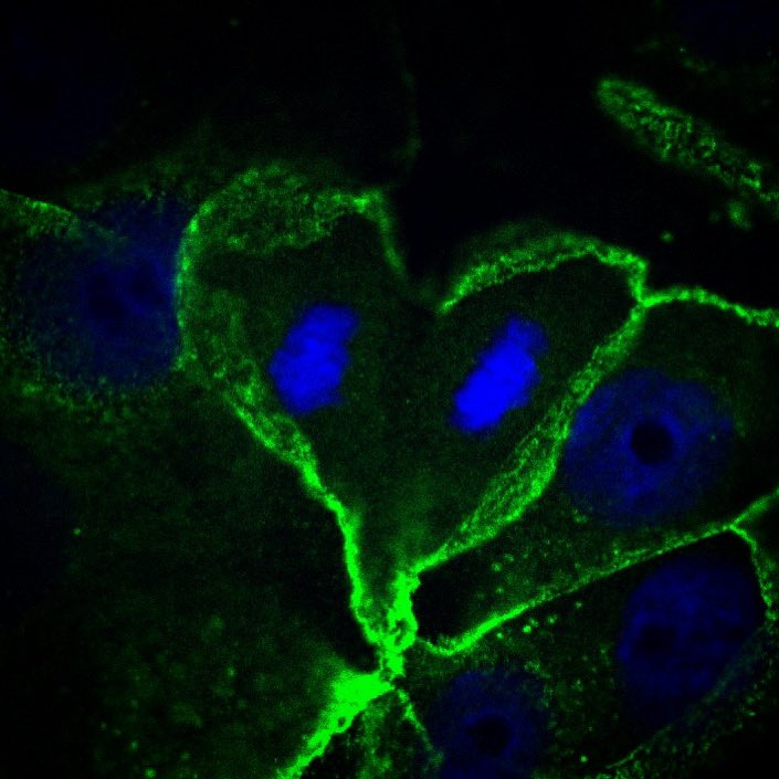 #FluorescenceFriday a cell finishing up division, I took this photo on Valentine’s Day of all days 🥰 #celldivision #mitosis #fluorescenceimaging #cellpics