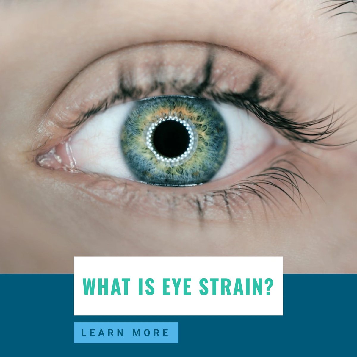 Eye straining can mean different things to different people. Some feel it is when the eyes are tired, while others have watery eyes or blurry vision. Read our blog to learn all about eye strain causes, how it's detected, and more: guptaeye.com/education/eye-….