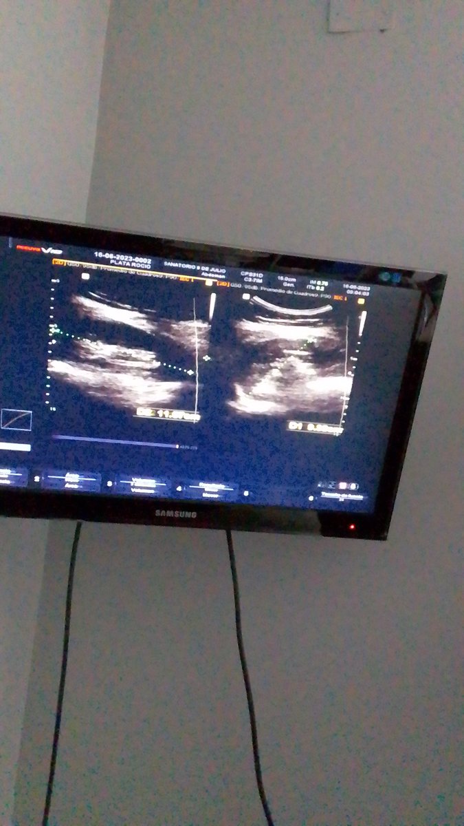 rocogodnt's tweet photo. 🤞🏻🤰🏼🤰🏼 https://t.co/ntoReGnvtt