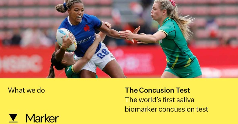 Test4Concussion's tweet photo. The Consensus statement from the International Conference on Concussion in Sport highlights,

"Advanced fluid-based biomarkers and emerging technologies are valuable research tools for the study of concussion".

See how @MarkerHC is pioneering this 👇

#concussion #playerwelfare
