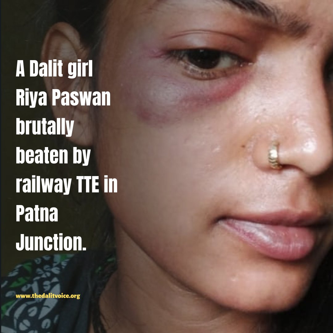 ambedkariteIND's tweet photo. #Atrocities A Dalit girl Riya Paswan brutally assaulted by Railway TTE in Bihar's Patna Junction l.

- @Satyamooknayak https://t.co/9Gyn6NGVNY