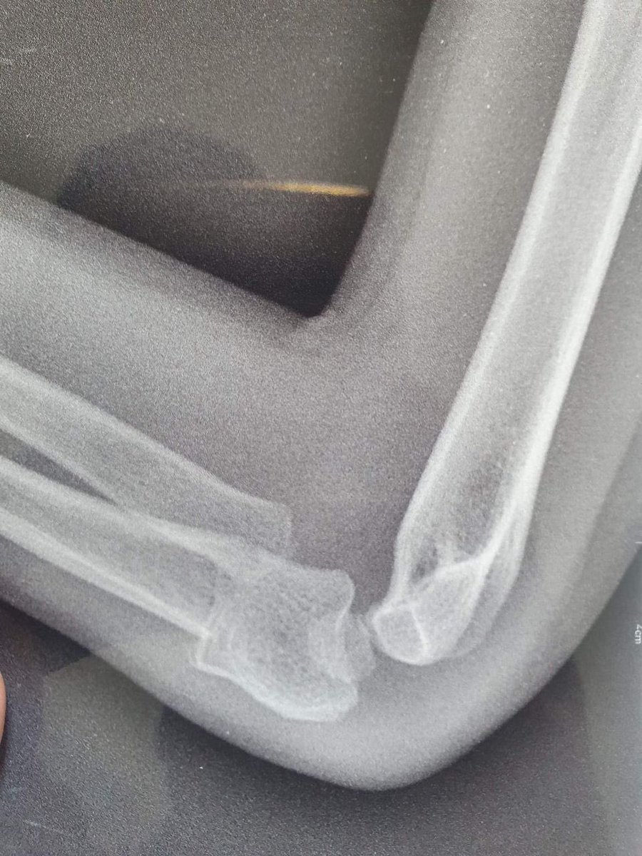 Safwan Gw 🦁 tweet media