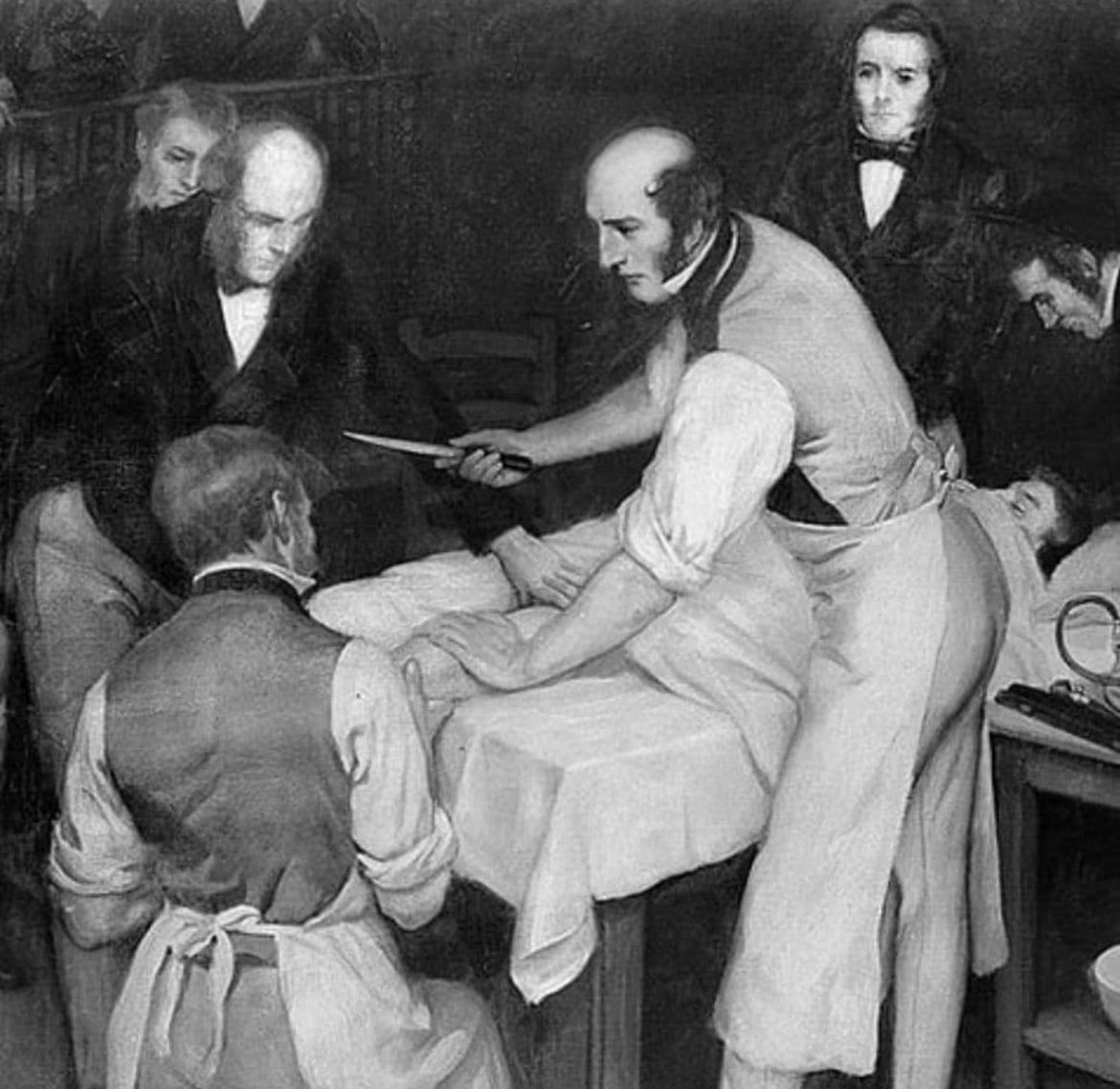 Robert Liston was a Scottish surgeon in the 1800s who is most famous for completing a surgery that resulted in a 300% mortality rate. 

He amputated the patient's leg in under 2.5 minutes, operating so quickly that in the process, he also amputated the fingers of his assistant…