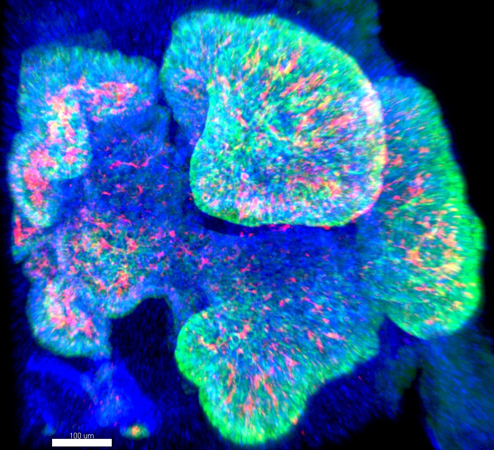 Wholemount staining of human pluripotent stem cell derived intestinal organoid. #FluorescenceFriday #cellbiology #sciart #bioart