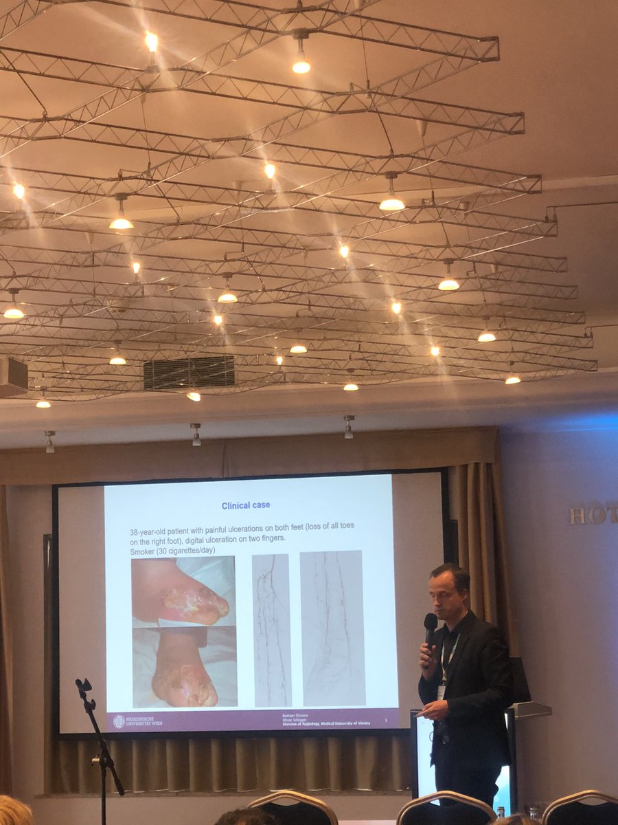 Second day over at #ESVMAcademy2023: from #Buerger disease to #Raynaud phenomenon and vascular #malformations. It was an intense day showing how much angiologists throughout #Europe are at the forefront of #VascularMedicine @alebura @SchlagerOliver @ESVM_ #Bratislava