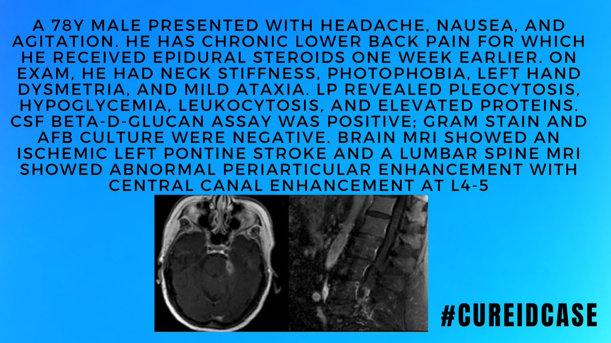 #CUREIDCase
Find more details on CURE ID that will help you make the correct diagnosis: cure.ncats.io/explore/discus…

#IDTwitter #IDMedEd #MedEd #IDCase #CUREID