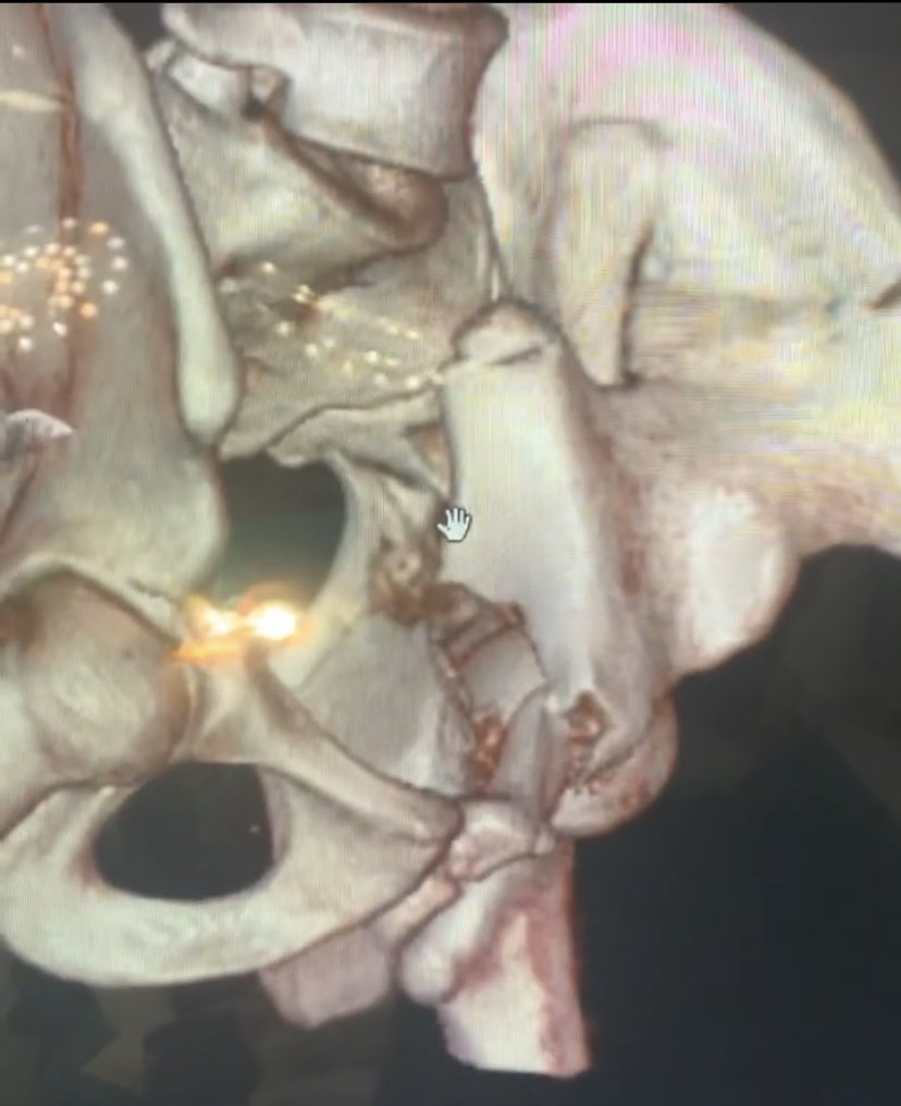 dr_haluk yaka tweet media