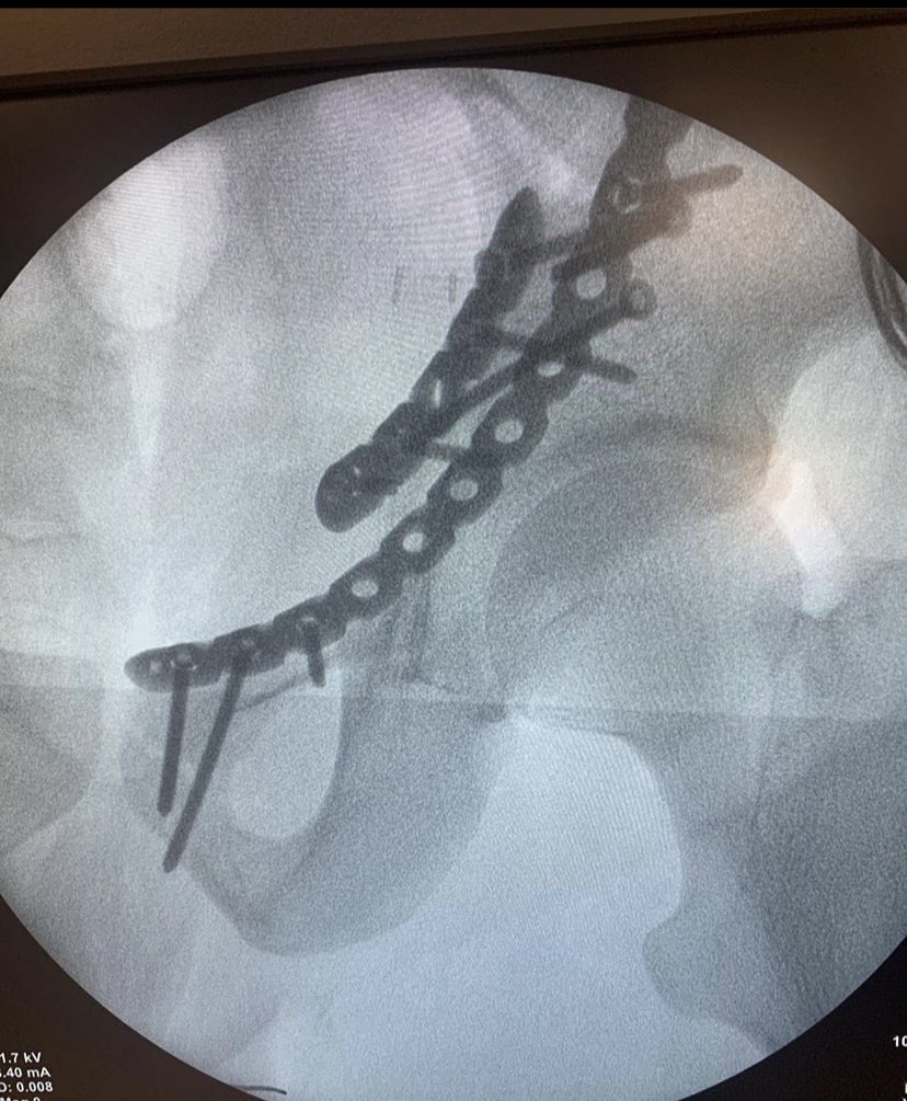 dr_haluk yaka tweet media