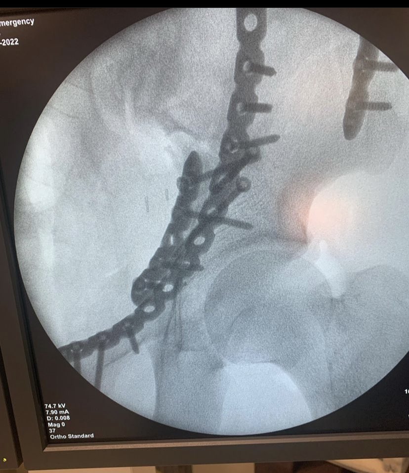 dr_haluk yaka tweet media