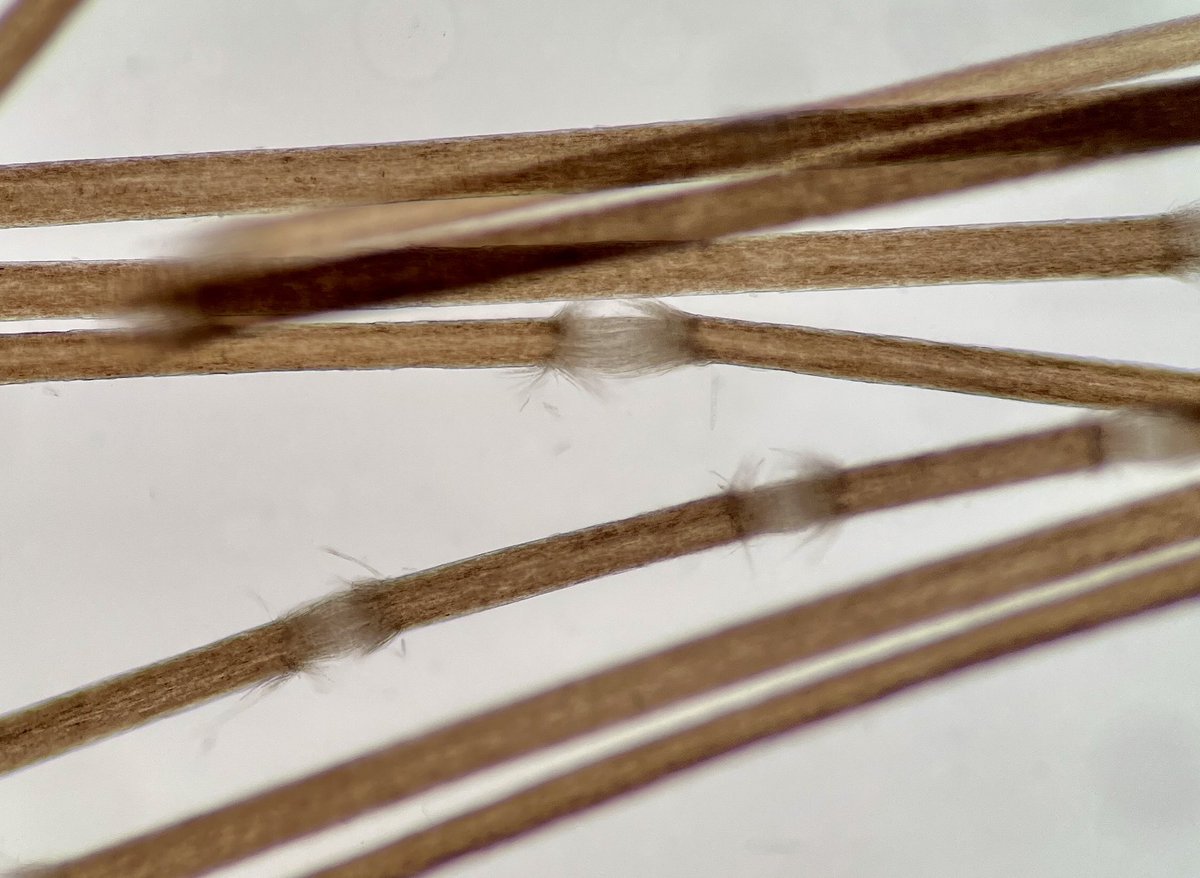 Jerad Gardner, MD on Twitter "RT SimonRoyMD Trichorrhexis nodosa