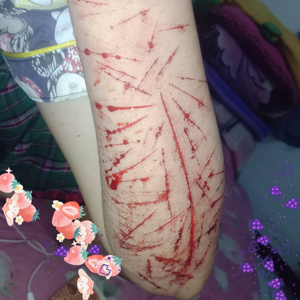 labumipebo's tweet photo. selfharm

is it just me or those fresh cuts look like fireworks https://t.co/VxY35WLhPW