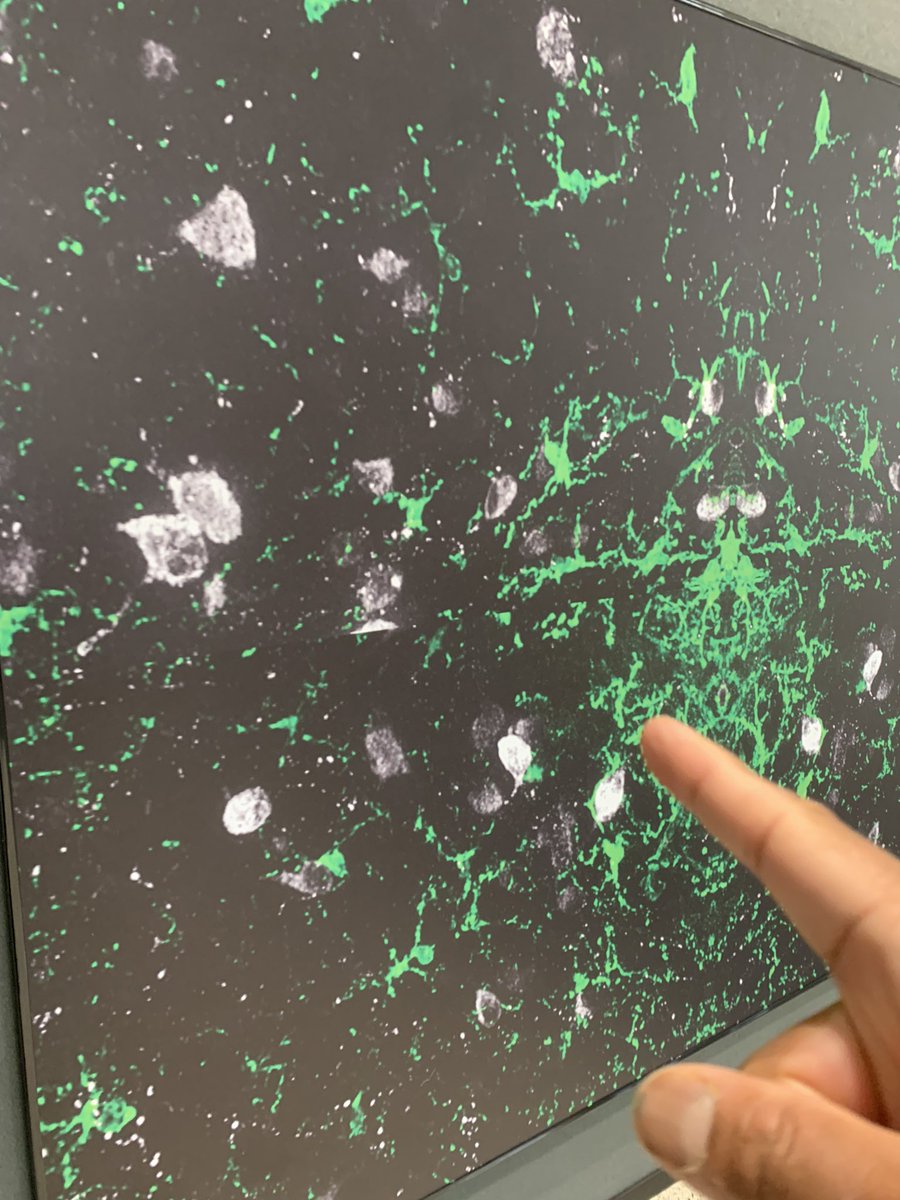 Suneil Koliwad (@suneilkoliwad) on Twitter photo Fabulous collab project with great colleague <a href="/Josh_Thaler/">Josh Thaler</a> lab at UW recognized <a href="/TheEndoSociety/">Endocrine Society</a> mtg, as amazing image of hypothalamic microglia alongside POMC neurons by <a href="/NiraulaAnzela/">Anzela Niraula</a> in Josh’s lab awarded the Grand Prize. Congrats Anzela! #ENDO2023 Fabulous collab project with great colleague <a href="/Josh_Thaler/">Josh Thaler</a> lab at UW recognized <a href="/TheEndoSociety/">Endocrine Society</a> mtg, as amazing image of hypothalamic microglia alongside POMC neurons by <a href="/NiraulaAnzela/">Anzela Niraula</a> in Josh’s lab awarded the Grand Prize. Congrats Anzela! #ENDO2023