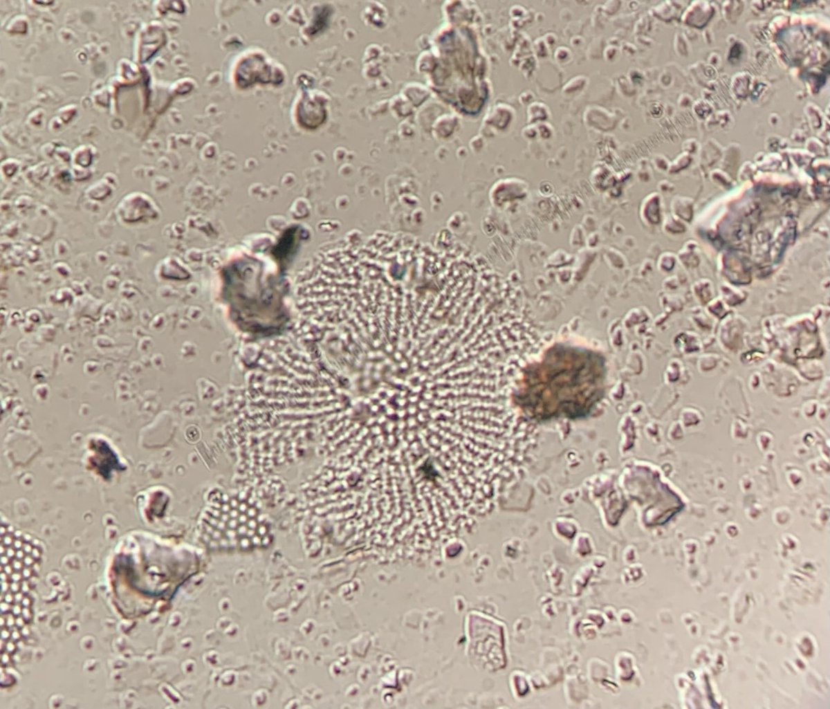 Some days I take photos of ugly #diatoms and wonder what they are… #BeringSea