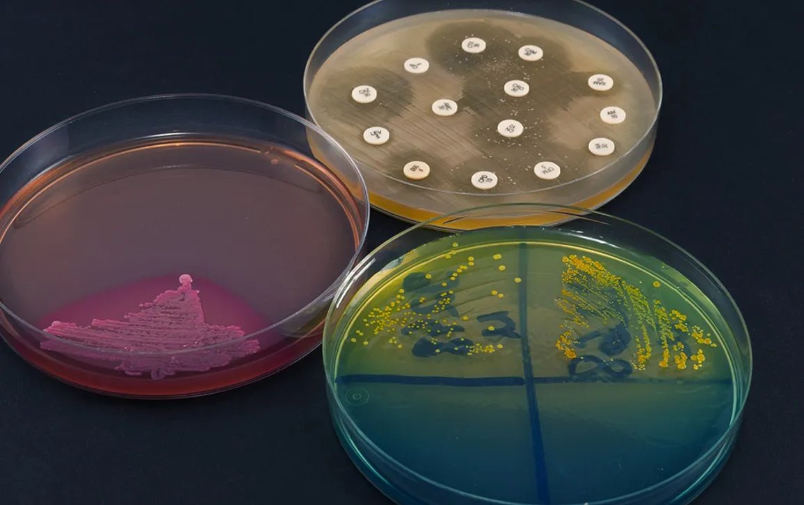 One #Healthapproach: #EuropeanUnion #strengthensaction to #combat #antimicrobial #resistance
Read more: shorturl.at/sAJS3
#Antimicrobial #DrugResistance
#ICR
#Manuscript 
#research 
#Japan