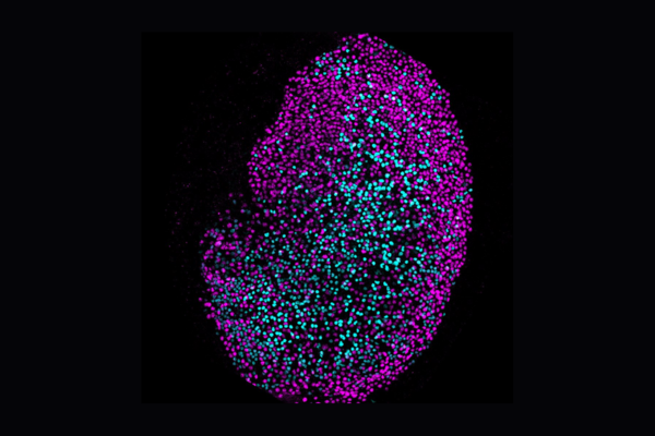 NIH_NIDCD's tweet photo. The deadline to register for #EARssentials2023 is July 10! Sign up for this free online course hosted &amp; taught by scientists primarily at NIDCD. (Those working at NIH may attend in person, as space allows.) See the course schedule: https://t.co/qyVwInxsBx #NIDCDtraining https://t.co/UyCTDpcd3r