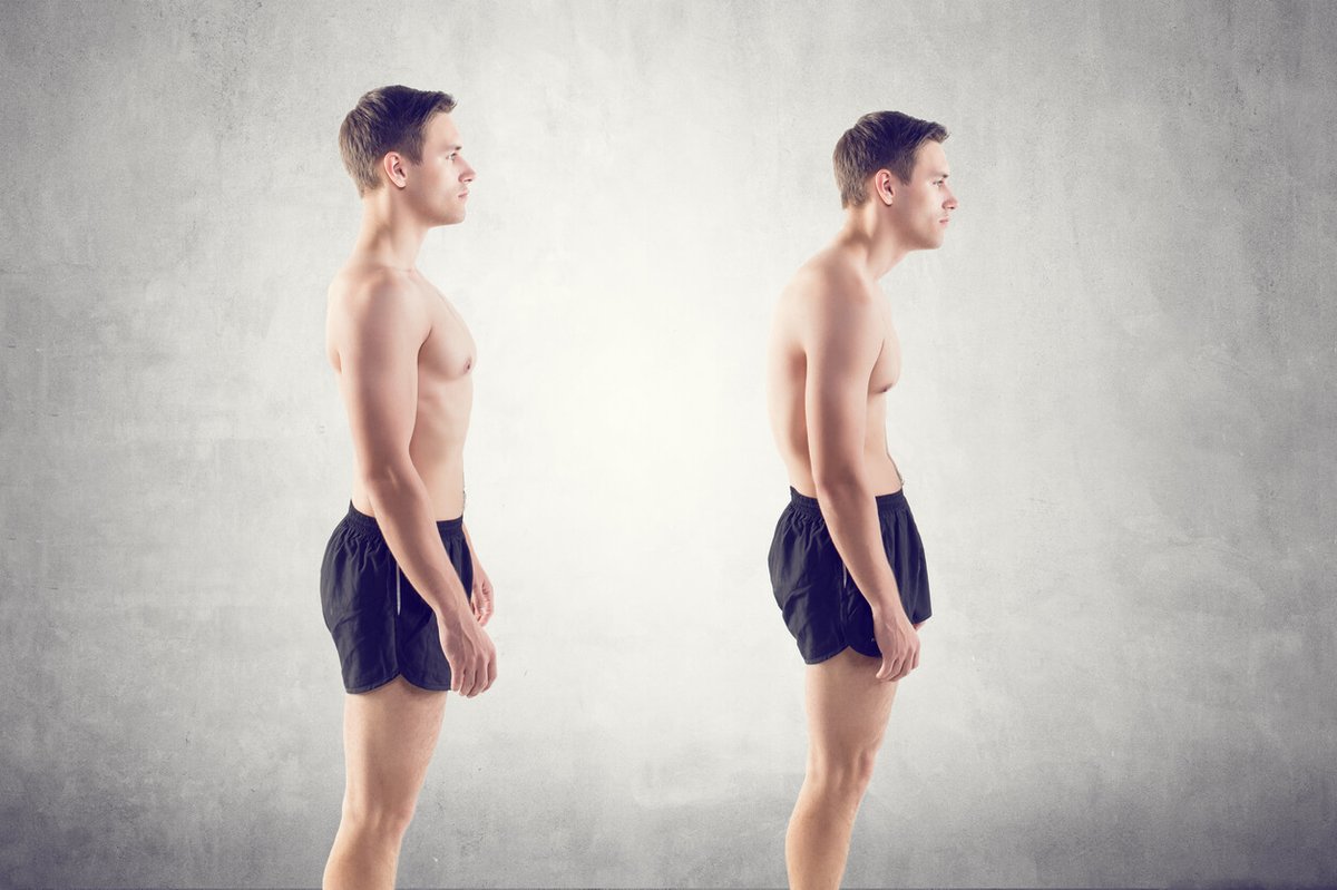 The Ultimate Guide to PERMANENTLY Fix Your Bad Posture: