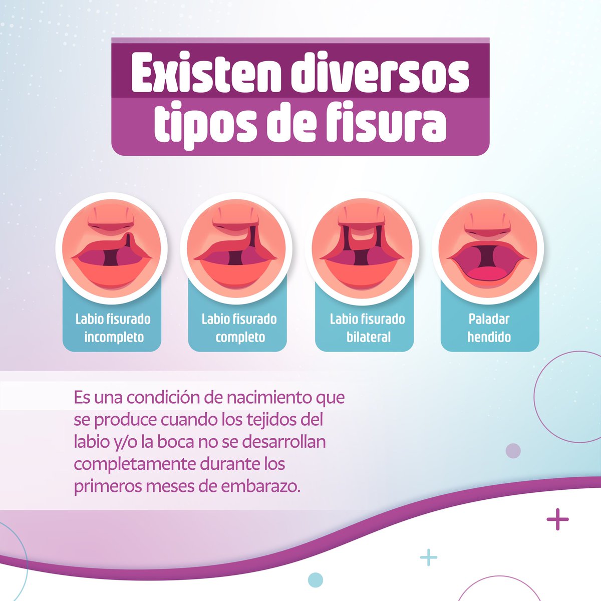 OSonrisaCo's tweet photo. Conozcamos más sobre el labio fisurado y paladar hendido. ¿Sabías que 1 de cada 800 niños y niñas en Colombia nace con esta condición? 

Un tratamiento integral y multidisciplinario puede mejorar la calidad de vida de los pacientes y hacer que su desarrollo sea óptimo. #salud https://t.co/ZeWTnTnFGr
