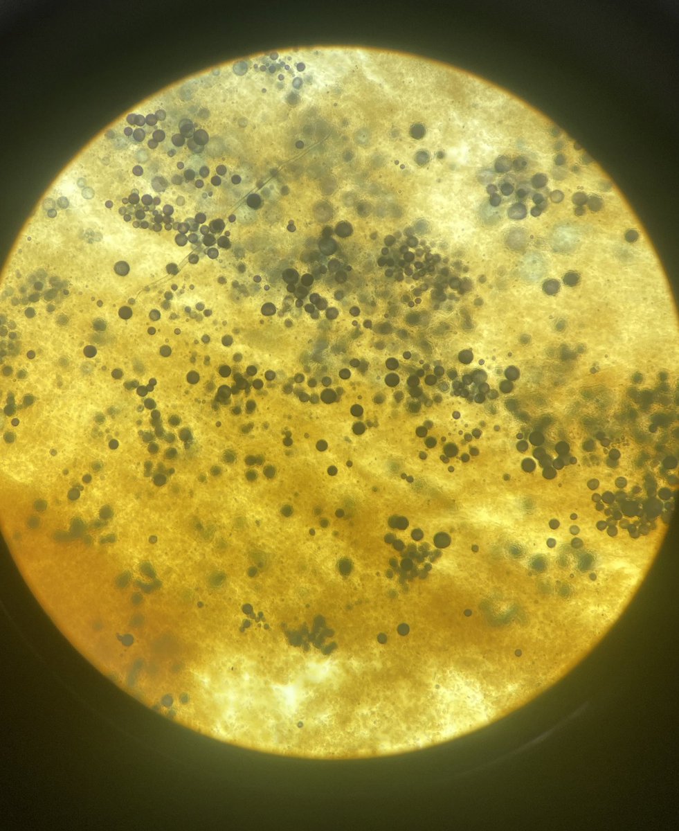 KachmarMariah's tweet photo. Hey Siri, que “Time of the season” by the Zombies. Morbidly excited to see disease progression in our samples. #RFTM #Dermo #perkinsus #LISoysters #Milfordlab https://t.co/BfBg6Bb1vF