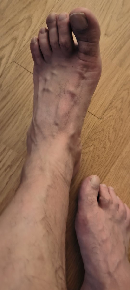 JavierDH76's tweet photo. #feetfethish #feetcontent #feetseller #feet_pic #FeetPicture #feetworshi̇p https://t.co/xP4IjQWsqs