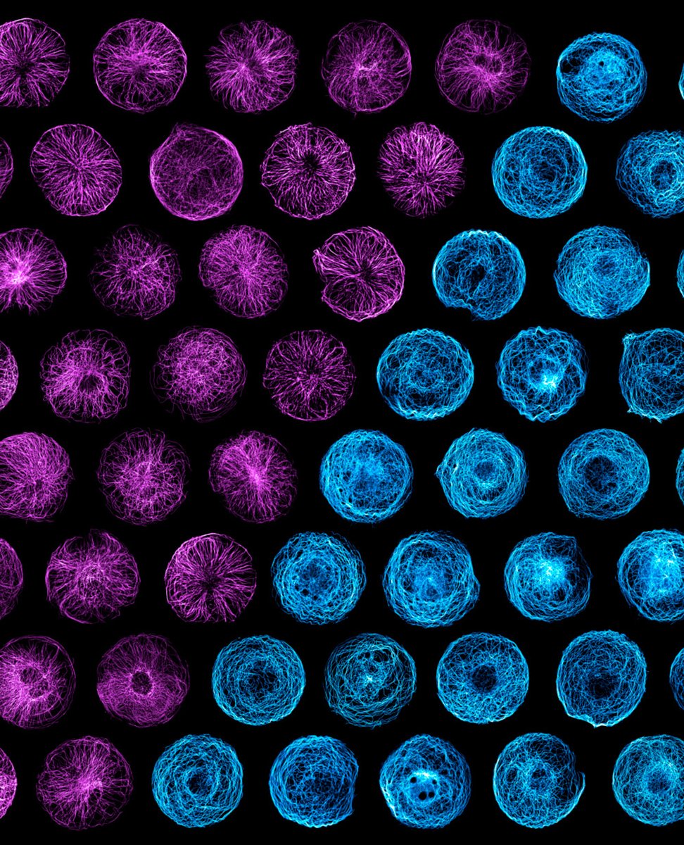 Microtubules are cellular mechano-sensors. They freeze in response to 10% cellular deformation. Read here the amazing work of @YuhuiLii now published in @NatureMaterials : rdcu.be/dfGtW