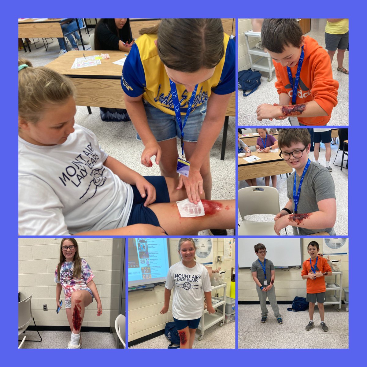 SarahKnott4's tweet photo. SCC career exploration camp medical students learning about wounds. These kids had fun creating fake wounds (no one was really hurt) and then told stories on how they received their injury. These future medical students have learned a lot this week. #masummer https://t.co/538g4MfKgn
