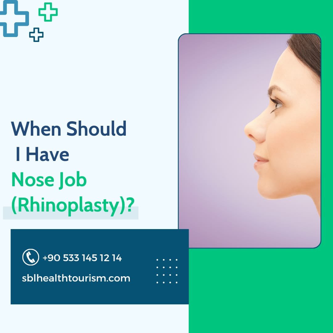 When Should I Have Nose Job (Rhinoplasty)?

instagram.com/p/CuFphDHrIka/…

#like
#dubai #sblhealthtourism #arabshealthtourism #nosejob #rhinoplasty #nosesurgery #nosejobistanbul #rhinoplastyistanbul #instagram #likesforlike #nosecontour #nosefiller #rhino #rhinoplasty #rhino3d