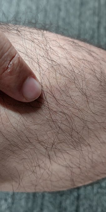 あかん労災クラスの大怪我したわ

ここぶつけた(';ω;`)
全治3分(';ω;`) 