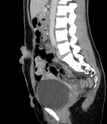Case 134: History withheld What's your diagnosis? Let us know by Friday, 7/7! @JimWuMSK @SDeshmukh_MD #MSKRad #radiology #radres #radfellows