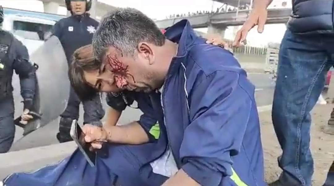 Coordinadora1DM's tweet photo. Así los maestros brutalmente golpeados por delincuentes con placa de @SS_Edomex de @alfredodelmazo @Edomex 
Por bloquear vialidades para que les paguen los adeudos que les deben
PEOTESTAR ES UN DERECHO ✌🏼
REPRIMIR ES UN DELITO https://t.co/JNxzN0rPxz