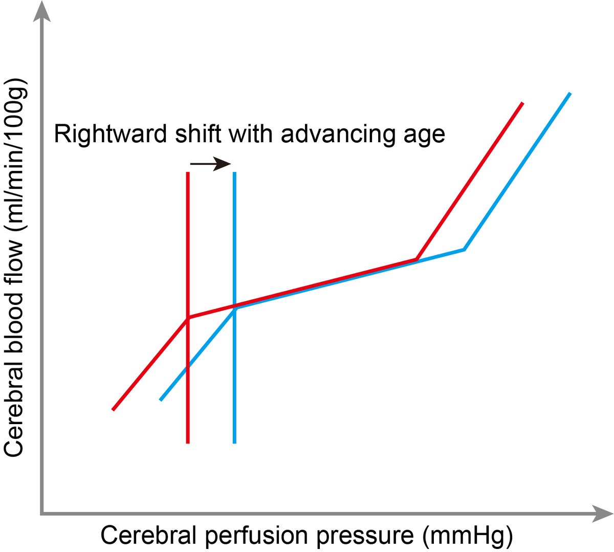 journal_aps's tweet photo. How anaesthesia affects cerebrovascular morbidity and mortality in those with brain frailty? The commentary is now online: Cerebral haemodynamics, anaesthesia and the frail brain
@LBeishon @DrJMinhas
https://t.co/L7x31pRC6b
#anaesthesia #brain #GeriatricAnesthesia https://t.co/zVEQUM67AV