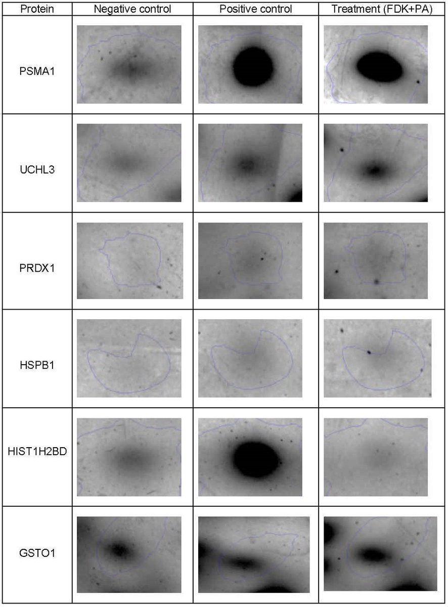 Can treatment with Ficus deltoidea reduce lipid accumulation, improve redox status and protein homeostasis?
ftb.com.hr/current-issue/…
#nonfattyliverdisease #ubiquitinproteasomepathway #steatosis #proteinhomeostasis #ftbjournal #OpenAccess