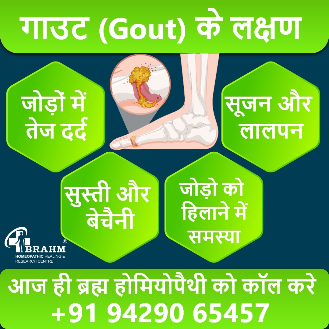 Gout Treatment In Homeopathy
#drpradeepkushwaha #brahmhomeo  #health #healthytips #healthylifestyle #asthmatreatment #bestmedicine #homeopathymedicine #healtheducation  #healthcare  #knowledgeofhomeopathy #viralpost #viralvideo #trending #trendingvideo #ahmedabad