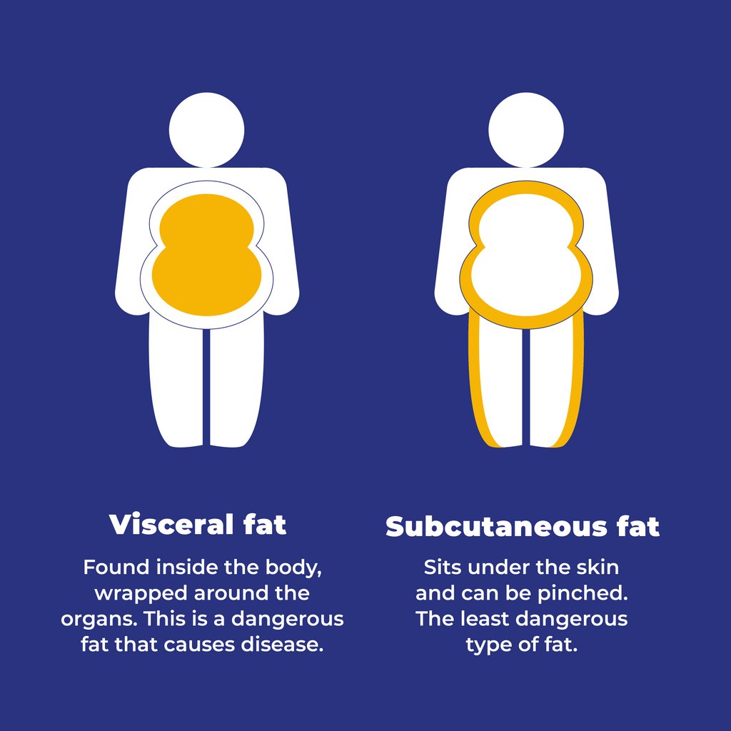 FatLadAtTheBack's tweet photo. There's different types of fat? 🤔 Turns out different types of fat do different things in the body and some types are more dangerous that others.
Did you know this? See our website to find more info on obesity.
#fatladattheback #visceralfat #fat #obese #obsity #overweight https://t.co/FHVuQK1g88