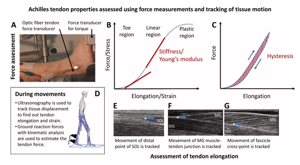 Retlouping's tweet photo. Towards modern understanding of the Achilles tendon properties in human movement research https://t.co/05YadSMuZI https://t.co/8jOLWh8UTE