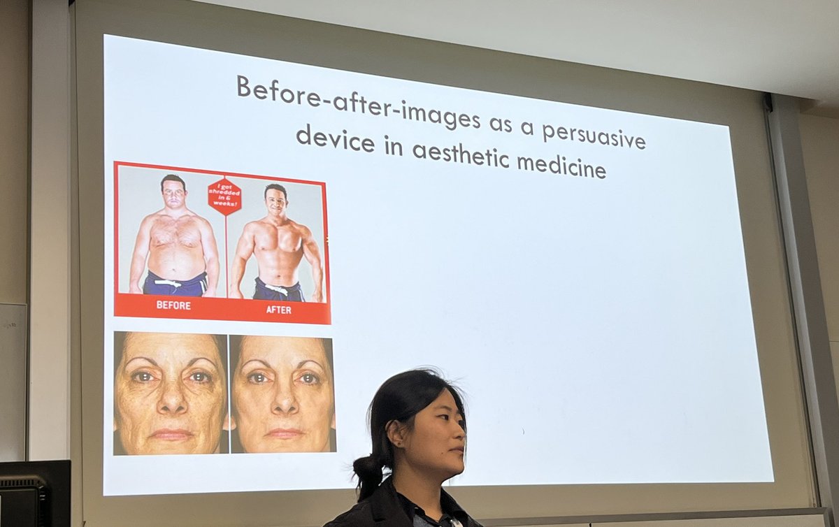 How are before-after images used as persuasive devices in cosmetic dentistry? Presentation by <a href="/yanniliu7/">Yani</a> #ICCA2023