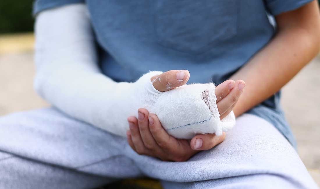 clin_pediatric's tweet image. A hand fracture is a broken bone in the long bones of the hand or the small bones of the fingers. Hand fractures in children can result from falls, sports injuries, crush injuries and various other forms of impact that apply enough force to cause injury.
#pediatrics #handfracture
