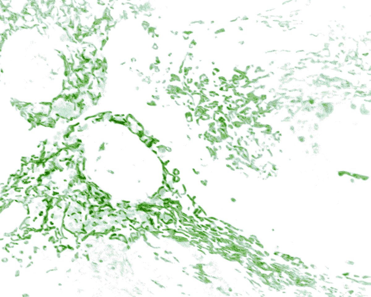 DNF_neuro's tweet image. Prof Jean-Yves Chatton revamped his website! His work focuses on astrocytes' role in the #brain, deciphering metabolic and signaling interactions. His lab explores how #astrocytes provide energy to neurons and modulate their activity. Stay tuned ! #Neuroscience