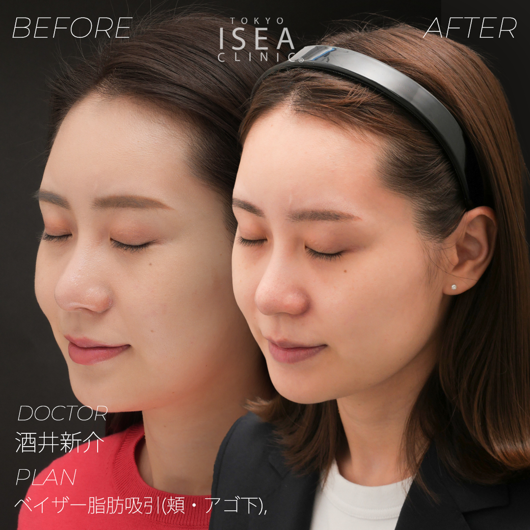 新しいHomePodはまだ木製の表面に汚れが残る場合がある