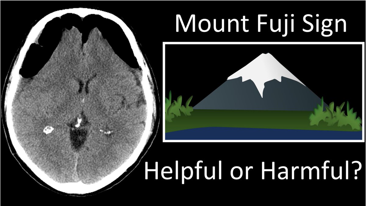 1/Controversy in radiology can get tense! The Mt Fuji sign for tension pnemocephalus is under scrutiny. When should you call it? 

A #tweetorial about imaging this important #neurosurgery complication 
#medtwitter #FOAMed #FOAMrad #medstudent  #radres #meded #neurotwitter
