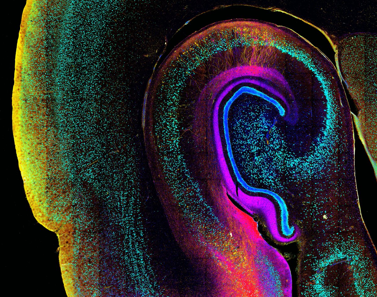 Danielle Beckman (@danibeckman) on Twitter photo The beginning of the end. Neurons dying (red/purple) after accumulating pTau in a monkey model of Alzheimer's disease. Healthy neurons in blue. #FluorescenceFriday <a href="/zeiss_micro/">ZEISS Microscopy</a> The beginning of the end. Neurons dying (red/purple) after accumulating pTau in a monkey model of Alzheimer's disease. Healthy neurons in blue. #FluorescenceFriday <a href="/zeiss_micro/">ZEISS Microscopy</a>