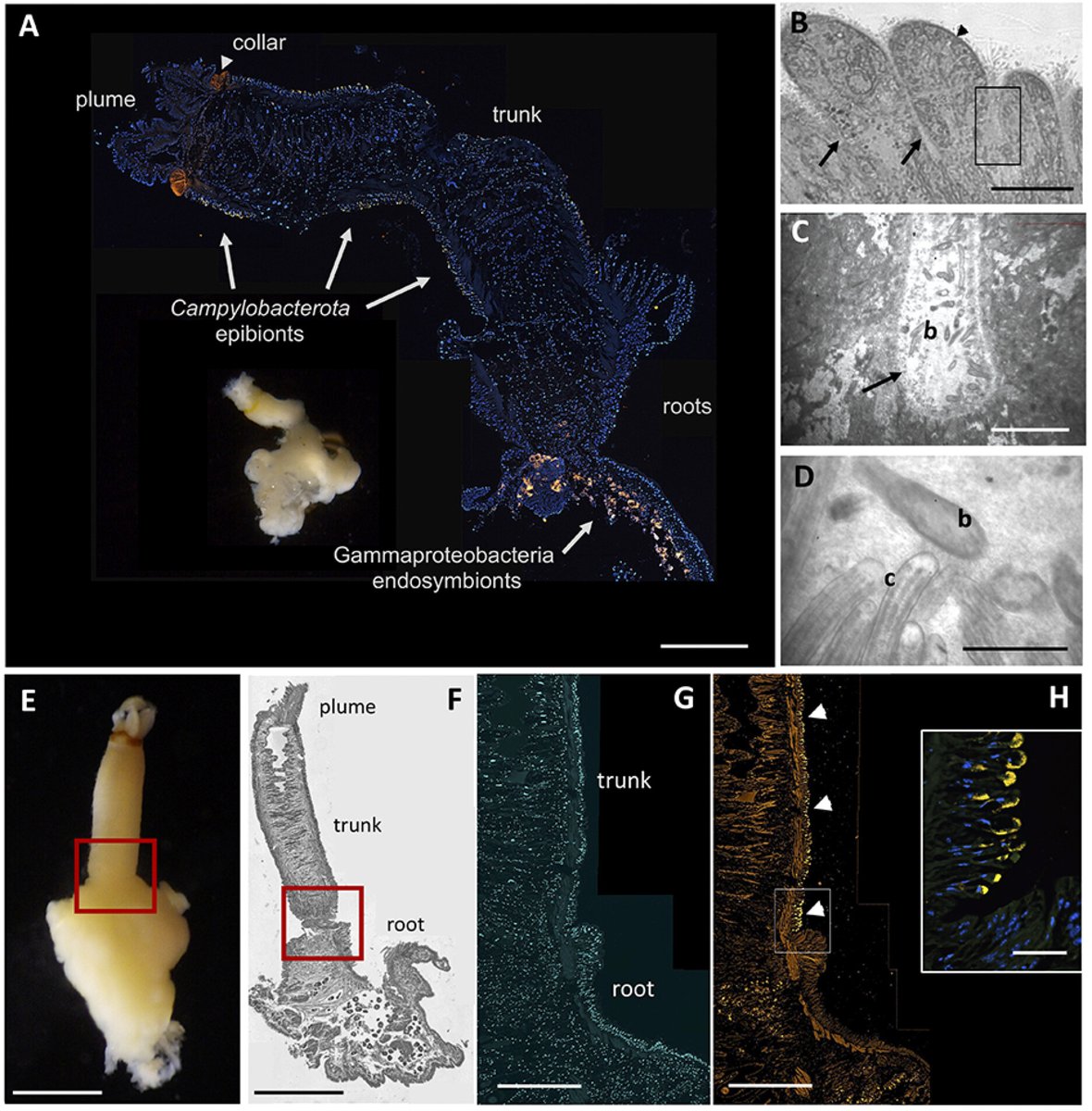 Osedax bone eating worms are covered in a dense blanket of epibionts with unique genomes that undergo a successional shift as the whale carcass degrades. Are they serving a protective function? Find out more in our new paper in <a href="/mbiojournal/">mBio</a> 🪱🦠 go Balig! 
doi.org/10.1128/mbio.0…