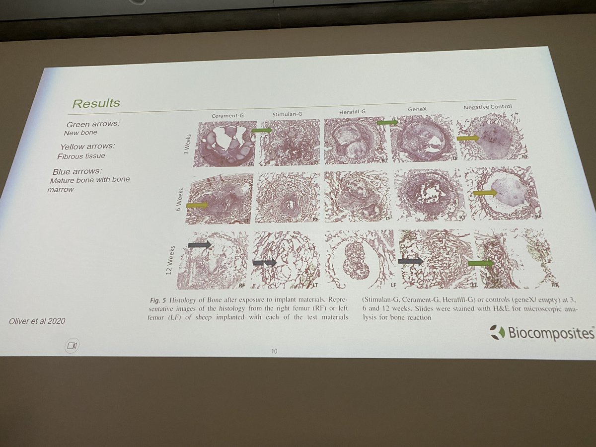 PrashVas's tweet image. Excellent engagement at #advances #diabeticfoot  seminar yesterday 
#KingsDFC- Sold out 6 weeks in advance (small numbers =⬆️ interaction)

We will be making this a regular event in #London in future.